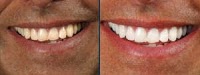 Bleach Free Smile Clinic 1078381 Image 2